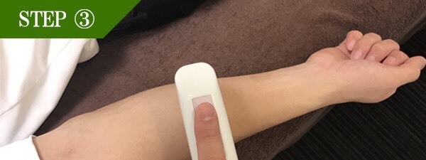 あごヒゲ脱毛Step3