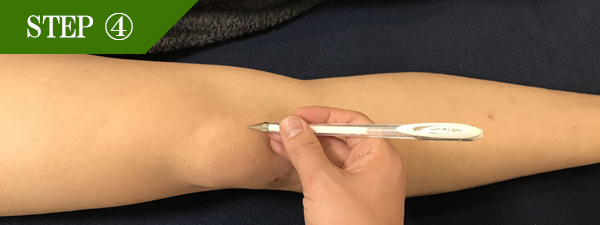 ひざ頭脱毛Step4