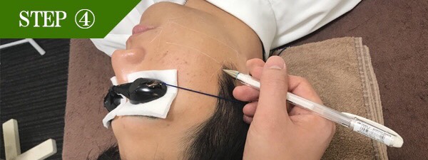 もみあげ脱毛Step4