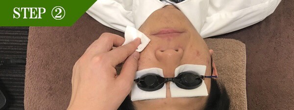 おでこ・眉間脱毛Step2